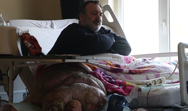 5 yıldır evden çıkamayan 300 kiloya ulaşan fil hastasının hayali; eşiyle kol kola caddede gezmek