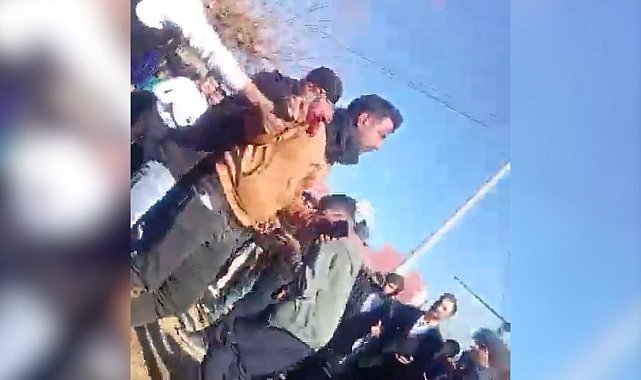 Davulcu, düğünde maganda kurşunuyla yaralandı