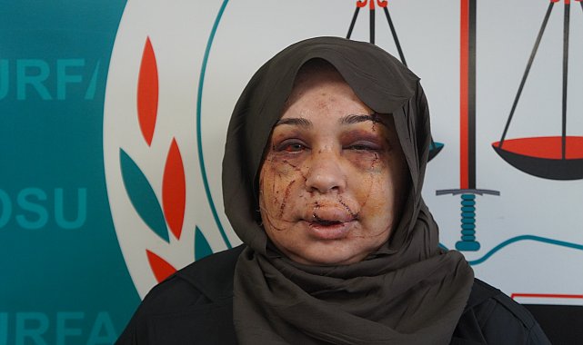 Polis eşi tarafından darbedildiği iddiasıyla şikayetçi oldu