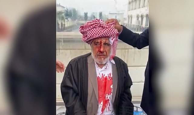 Şanlıurfa'da sopayla darba 4 tutuklama