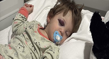 'Çocuk annesinin kucağından düştü, babası kendi burnundaki kanı üzerine akıttı'