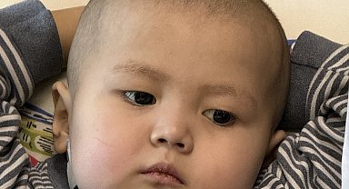 3 yaşındaki Nuryiğit, karaciğer nakliyle hayata tutundu