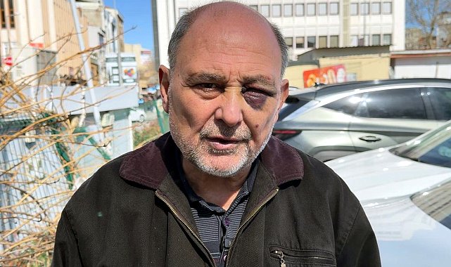 Annesinin cenazesinden dönüşte darbedildi: Çift görüyorum, iyi değilim, şikayetçiyim