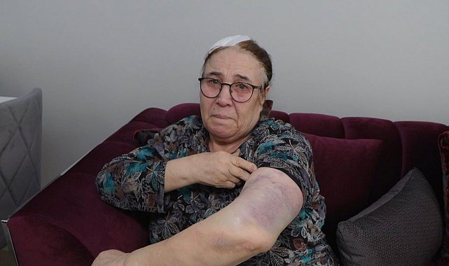 İstanbul- Esenyurt'ta bir yıldır tehdit ettiği çifti sopayla darbetti