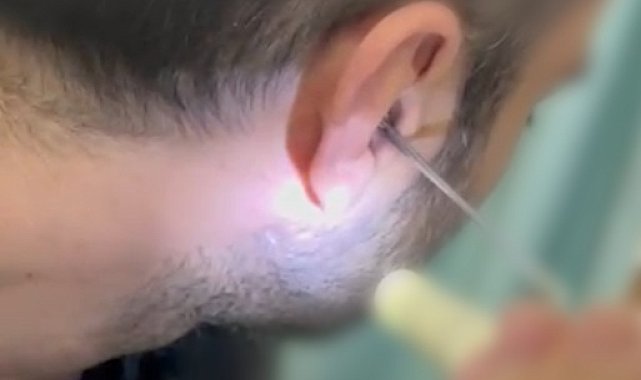 Kulağına gizlediği uyuşturucuyla yakalandı