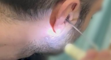 Kulağına gizlediği uyuşturucuyla yakalandı