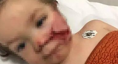 Ankara'da 2 kardeşi yaralayan pitbullun sahibinin annesi hakkında suç duyurusu kararı