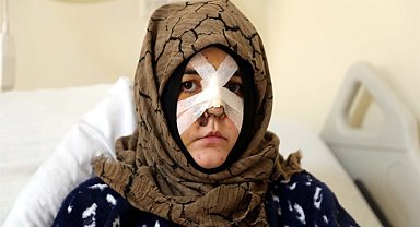 Boşanma aşamasındaki eşine vurduğu kaldırım taşı 'silah' sayıldı