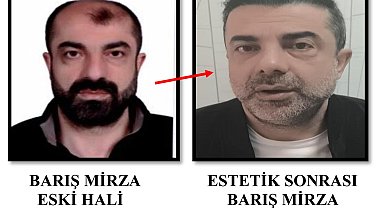 Cinayette azmettirmekten aranan şüpheli, ameliyatla yüzünü değiştirmiş