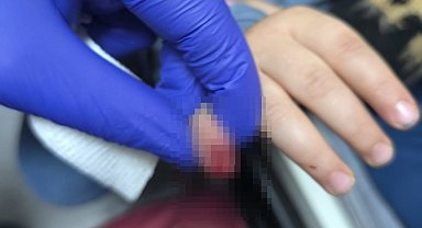 Yürüyen merdivene eli sıkışan çocuğun kopan parmağı kurtarılamadı