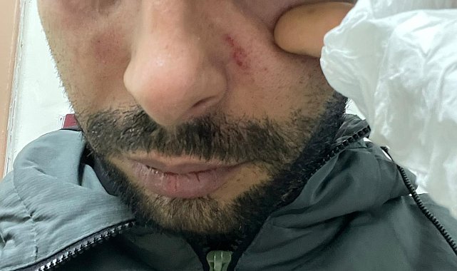 Hastaya yumruk attığı iddiasıyla doktora dava