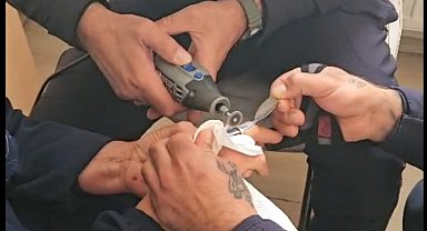 Parmağına sıkışan yüzüğü itfaiye çıkardı