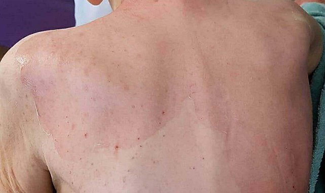Huzurevinde ölüme verilen taksitli para cezasının gerekçesi: Gerekli tedbirler alınmamış