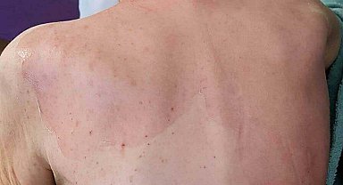Huzurevinde ölüme verilen taksitli para cezasının gerekçesi: Gerekli tedbirler alınmamış