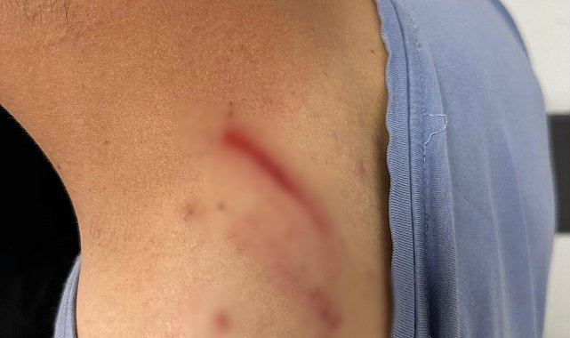 İlaç raporu tartışmasında tıbbi sekreteri darbetti