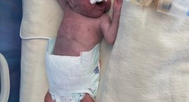 500 gram doğan Doruk bebek, 5 aylık yaşam mücadelesini kazandı