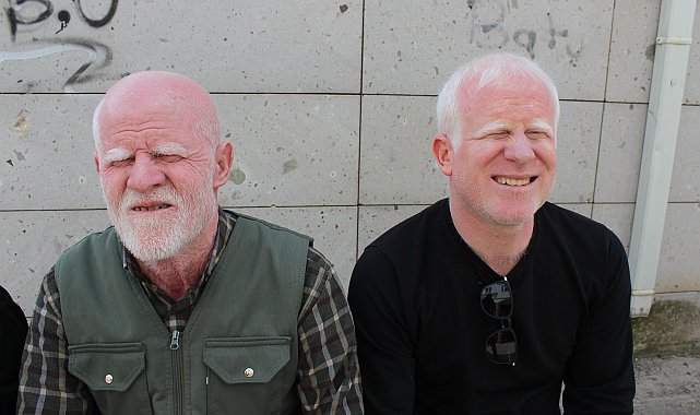 Ailesinin geçimi, babası ve kardeşi gibi kendisi de albino olan Gökhan'a emanet