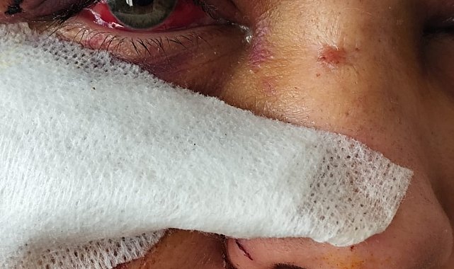 Boşanma aşamasındaki eşini darbeden polis memuruna hapis ve tahliye