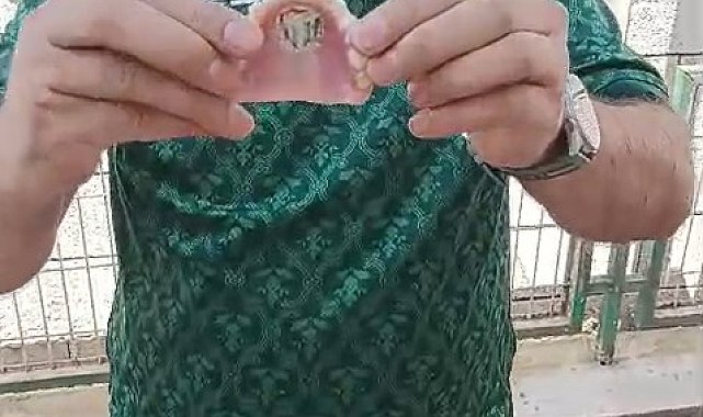 Bursaspor'un fanatik taraftarı takma dişinin damağına da kulüp amblemi yaptırdı