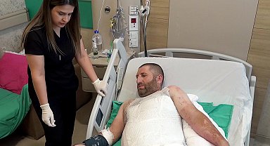 Çalışırken akıma kapılıp vücudunun 3'te 1'i yandı: Elektrik şakaya gelmiyor