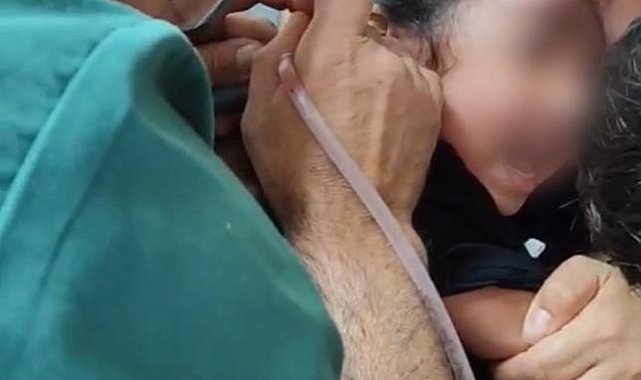 Çocuğun kulağından canlı kene çıkarıldı