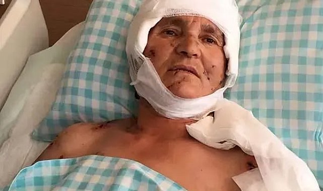 Köpek saldırısında yaralanan kadına 637 bin lira tazminat kararı