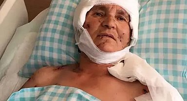 Köpek saldırısında yaralanan kadına 637 bin lira tazminat kararı