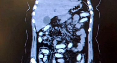 Midesinde 1,5 kilo metamfetaminle yakalanan 2 kadın kurye tutuklandı