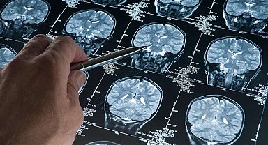 Araştırma: Derin uyku Alzheimer'ı yavaşlatıyor