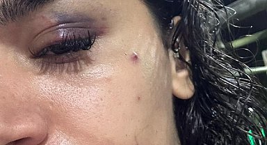 Bahçeşehir'de uzaklaştırma kararına rağmen evinin önünde darbedilen Ebru: Ölmeden önce sesimi duyun