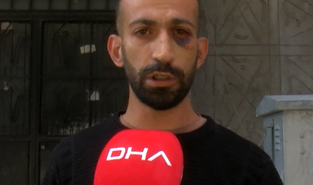 Gaziosmanpaşa'da taciz iddiasıyla darbedilen kiracı: Fatura ödemeleri yüzünden tartıştık