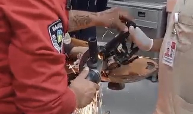 Kazada motosiklet sürücüsünün ayağına demir parçası saplandı