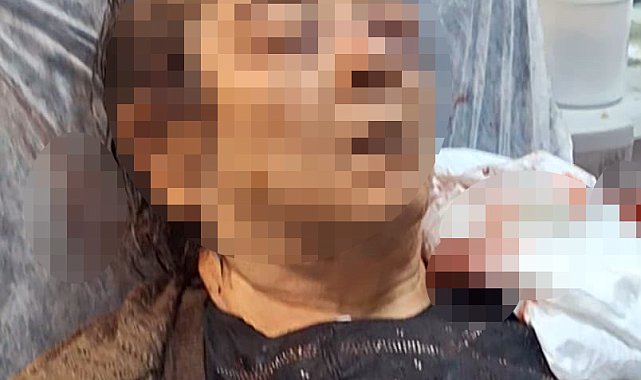Evde otururken tavandan kopan moloz yığını altında kalan kadın yaralandı