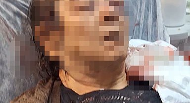 Evde otururken tavandan kopan moloz yığını altında kalan kadın yaralandı
