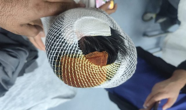 Eve dönerken köpeklerin saldırısına uğrayan öğrencinin başına 15 dikiş atıldı
