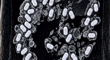 Havalimanında şüpheli yolcunun midesinden 322 gram metamfetamin çıktı