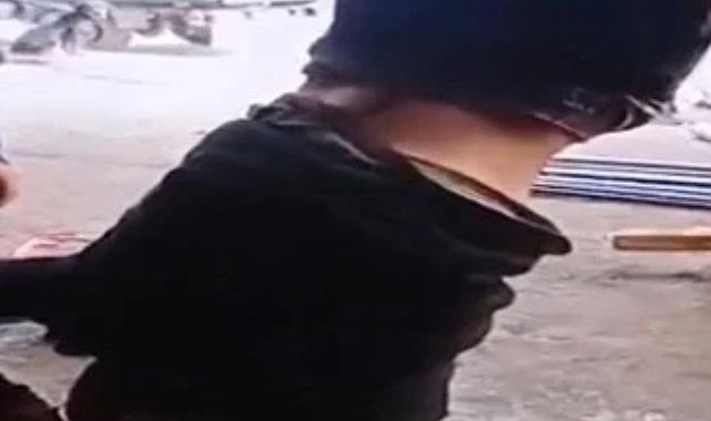 Zihinsel engelli işçiyi vince asan sanıkların imza atma adli kontrolü kaldırıldı